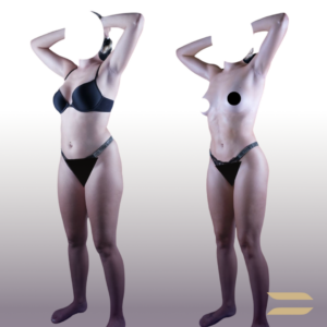 Liposuction